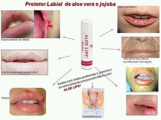 Aloe Lips – Image 3