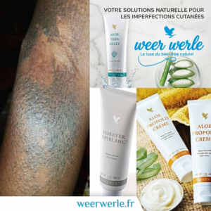Gamme Spéciale Imperfections Cutanées