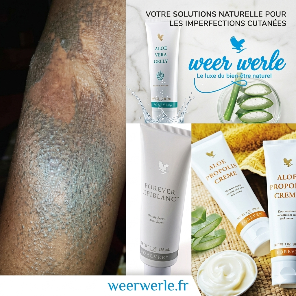 Gamme Spéciale Imperfections Cutanées