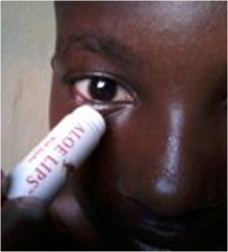 Aloe Lips – Image 2